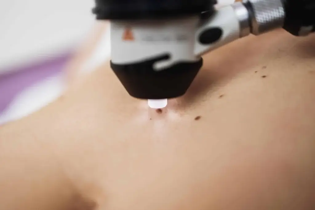 Close up shot of modern dermatology skin check