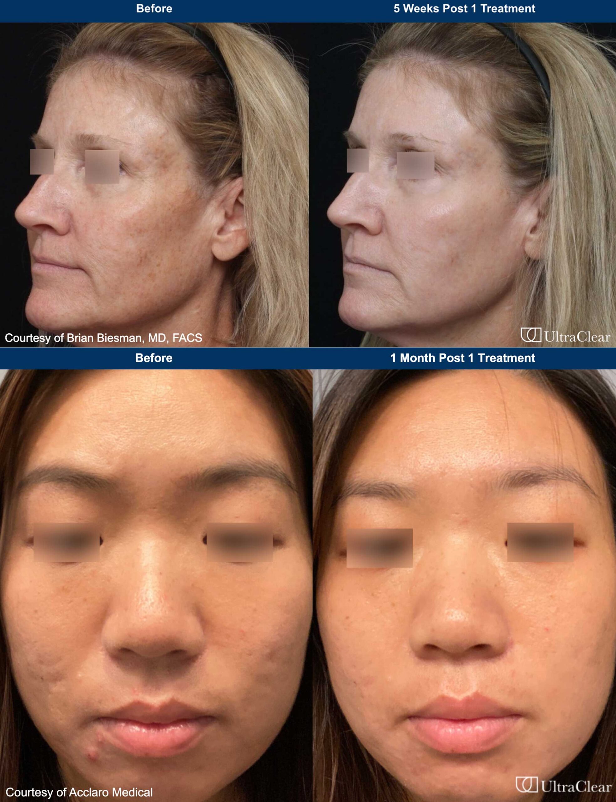 UltraClear - Swann Dermatology Partners