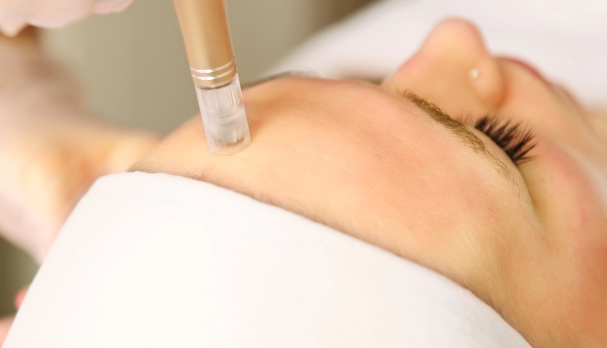 Beautician-cosmetologist-doing-procedure-fractional-microneedle
