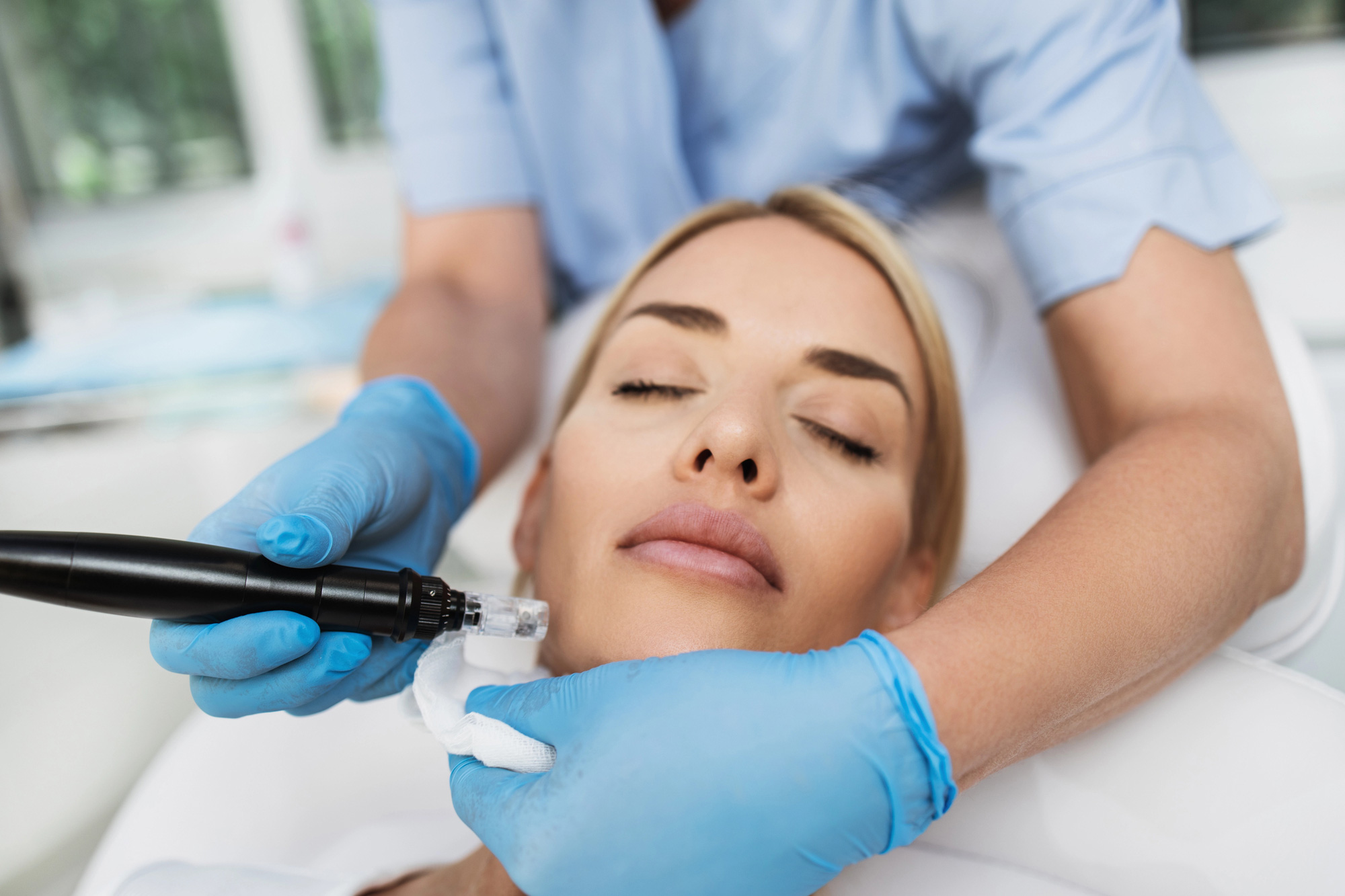 Microneedle-mesotherapy