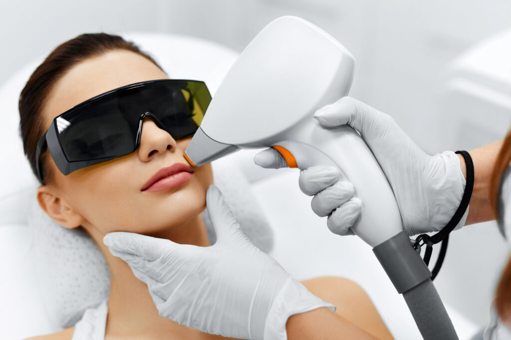 Facial-laser-hair-removal