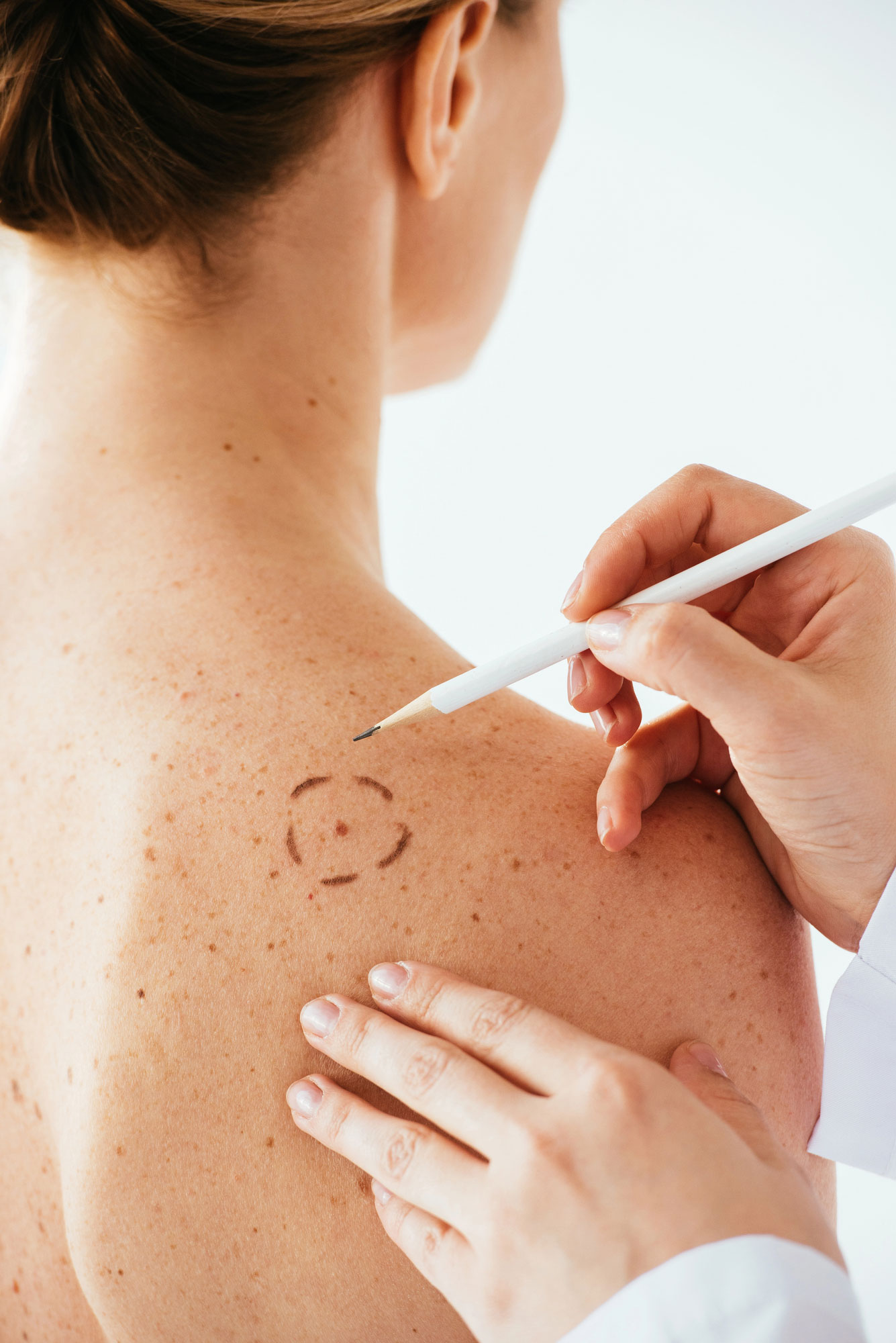 Cropped view of dermatologist applying marks on skin